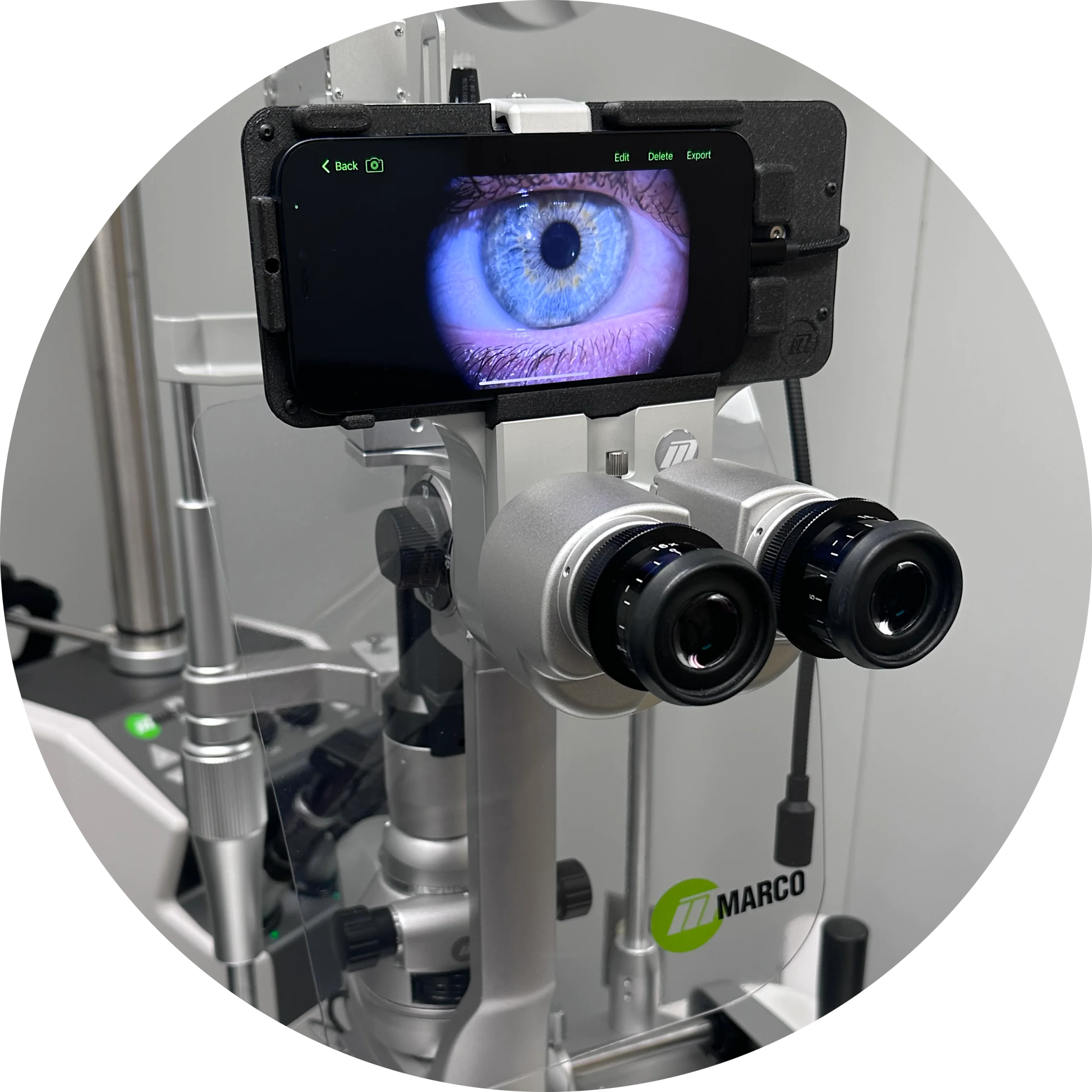 Capital Eye Care | Services and Tech